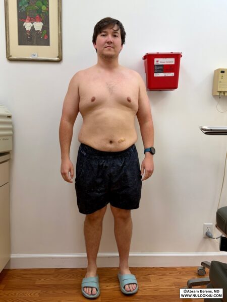 Medical weight loss, before-and-after patient photo (4 of 6)