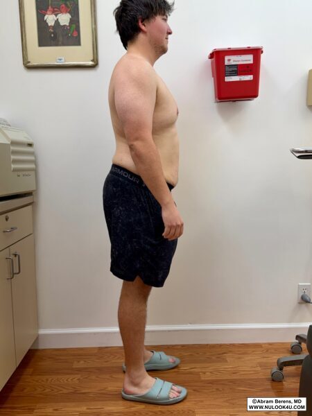 Medical weight loss, before-and-after patient photo (3 of 6)