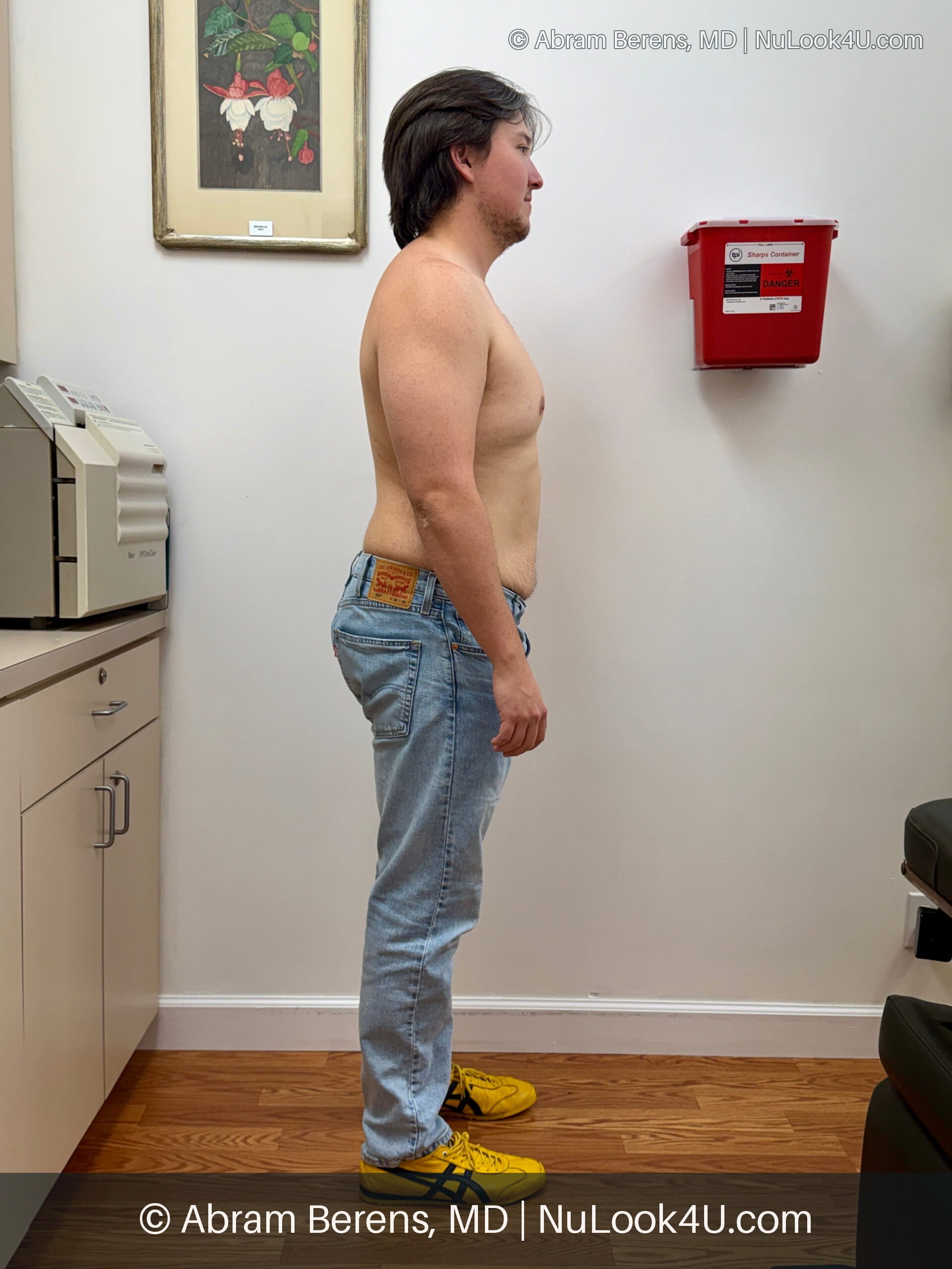 Medical weight loss patient, full-length front view (6 of 6)